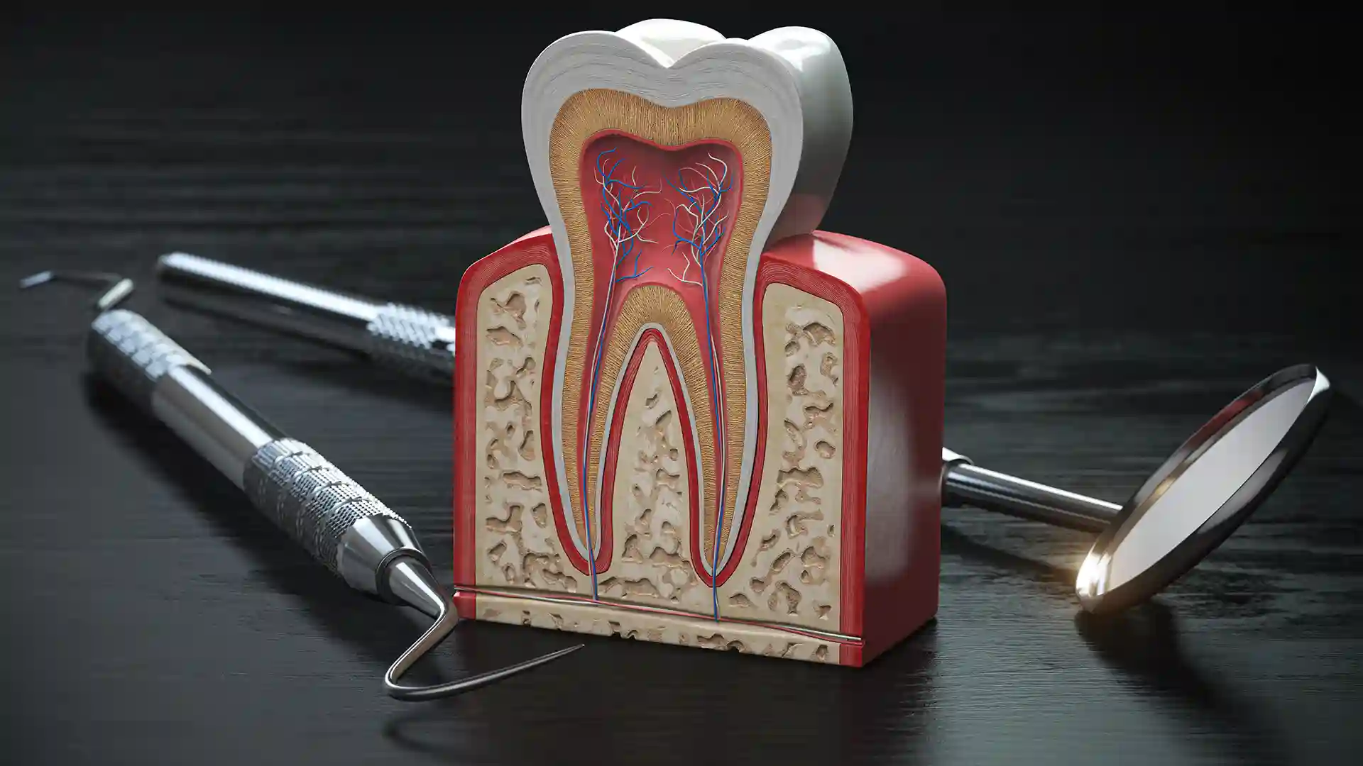Root Canal Treatment